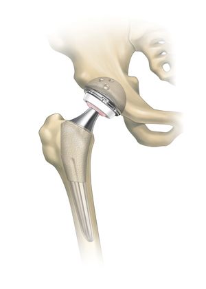 499981ac17f22307a5a7084fa9c2b1e2